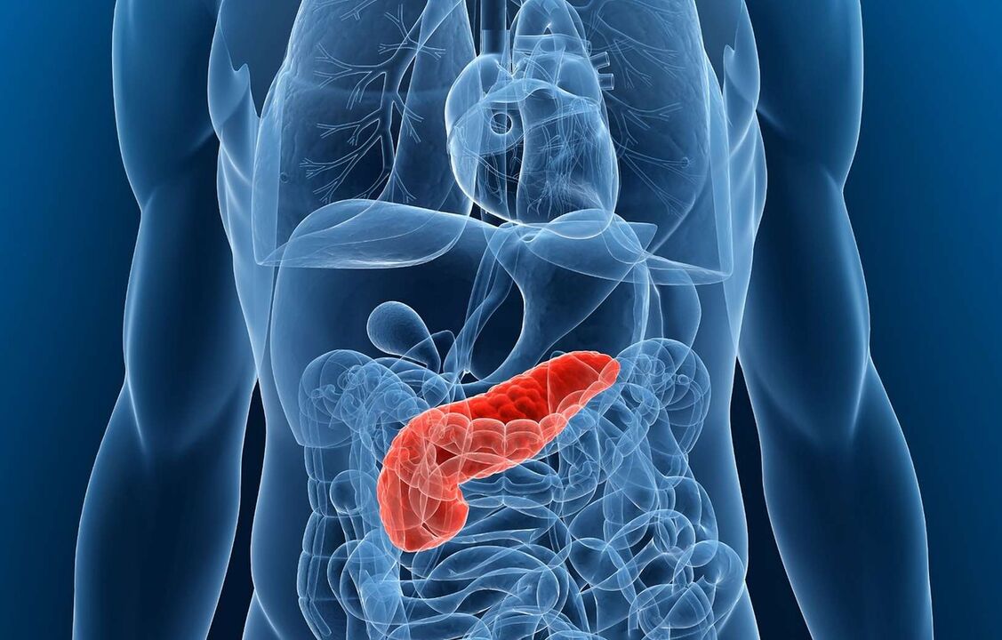 Inflamación del páncreas complicada por pancreatitis. 